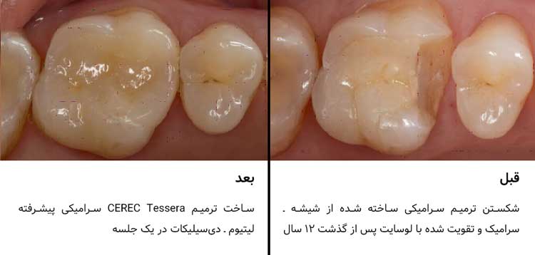 اینله سرک تسرا 