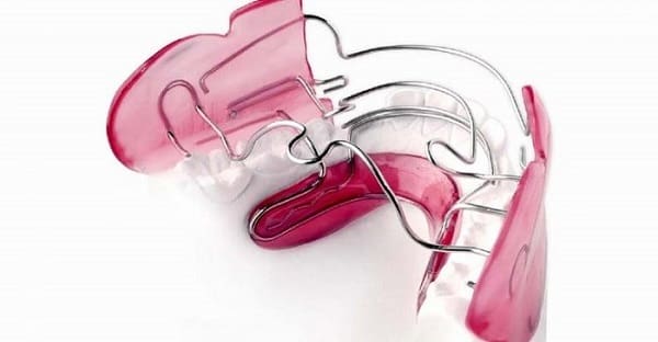 استفاده از ابزار ارتودنسی فانکشنال