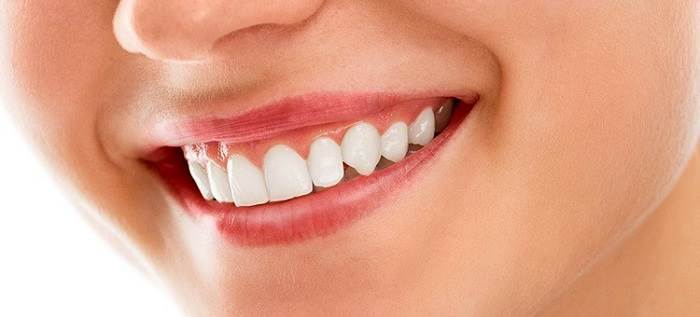 درمان پیگمنتیشن لثه