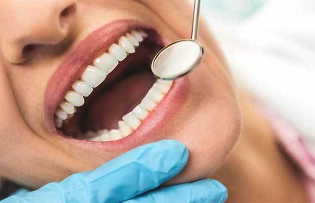 مراجعه مرتب به دندانپزشک بعد از لمینت کردن دندانها